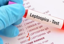 ¿Qué es la leptospirosis, causante de la muerte de 8 niños en Taisha? 