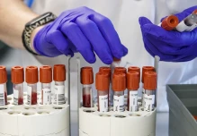 OMS: La hepatitis podría ser más letal que la malaria, la tuberculosis y el sida en 2040