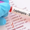 ¿Qué es la leptospirosis, causante de la muerte de 8 niños en Taisha? 