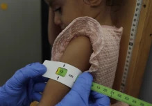 Uno de cada cuatro menores de 5 años en Ecuador no alcanza la talla esperada