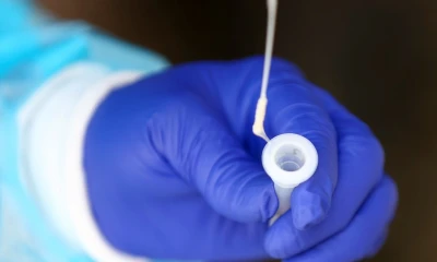 Ecuador reporta 3.094 positivos y suma 567.332 casos históricos de covid-19 / Foto: EFE