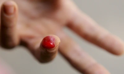 Los investigadores han concluido que se da una reducción de dos tercios en los casos de paludismo, incluidos los casos más graves, y en el número de fallecimientos/ Foto: cortesía EFE