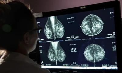 Se pueden identificar hasta un 20 % más de tumores en comparación con los métodos convencionales/ Foto: cortesía 