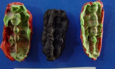 Los investigadores encontraron una gran cantidad de bacterias asociadas a enfermedades de las encías en las muestras analizadas/ Foto: cortesía EFE