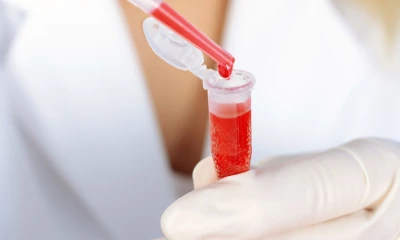 La próxima semana se recibirá un lote del medicamento Factor VIII plasmático 250 UI y 500 UI / Foto: cortesía 