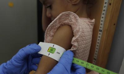 Uno de cada cuatro menores de 5 años en Ecuador no alcanza la talla esperada / Foto: EFE