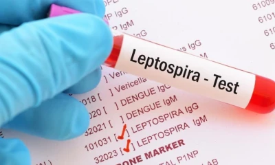 La leptospirosis es una enfermedad que puede transmitirse de animales a personas / Foto: cortesía Medical News Today
