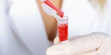 El Gobierno compró medicinas para hemofilia en $ 1,4 millones ante desabastecimiento
