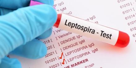 ¿Qué es la leptospirosis, causante de la muerte de 8 niños en Taisha? 