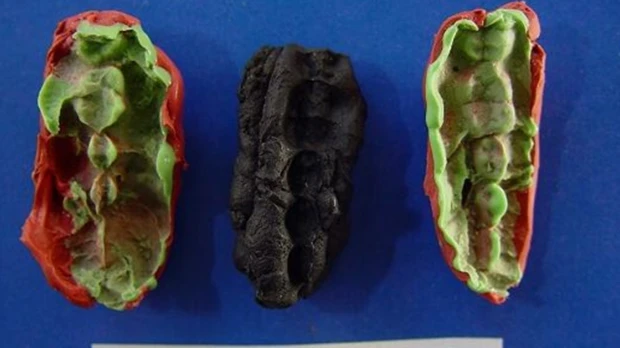 Hace 10.000 años, el hombre ya sufría de caries y enfermedades de las encías