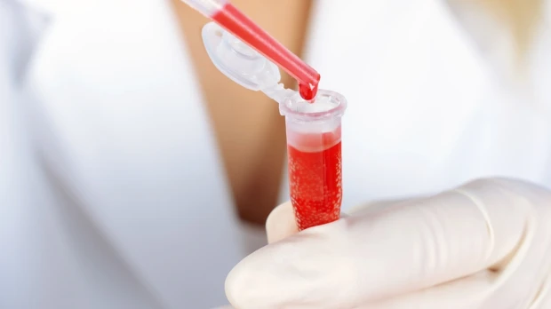 El Gobierno compró medicinas para hemofilia en $ 1,4 millones ante desabastecimiento