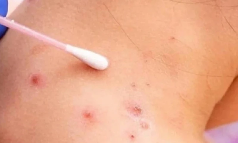 Noticias del Ecuador Medios Nacionales - 7 de Septiembre de 2022 / Foto: cortesía EFE