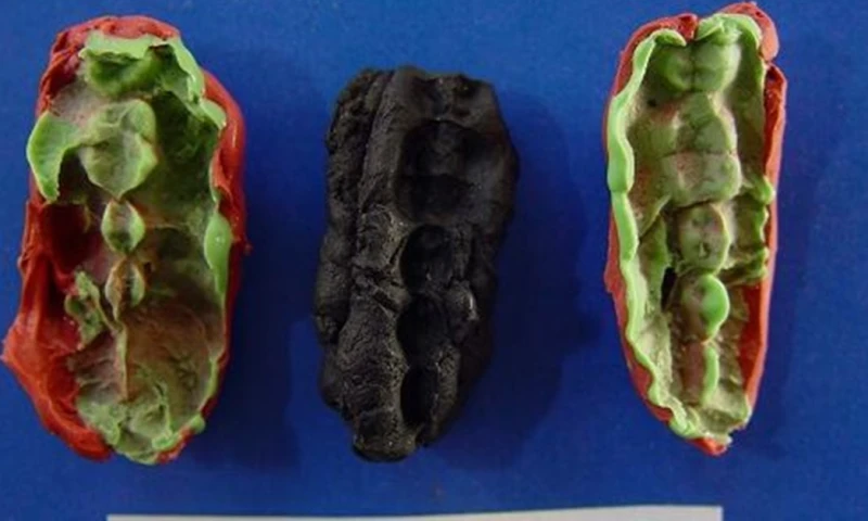 Los investigadores encontraron una gran cantidad de bacterias asociadas a enfermedades de las encías en las muestras analizadas/ Foto: cortesía EFE