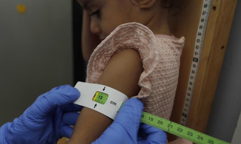 Uno de cada cuatro menores de 5 años en Ecuador no alcanza la talla esperada / Foto: EFE