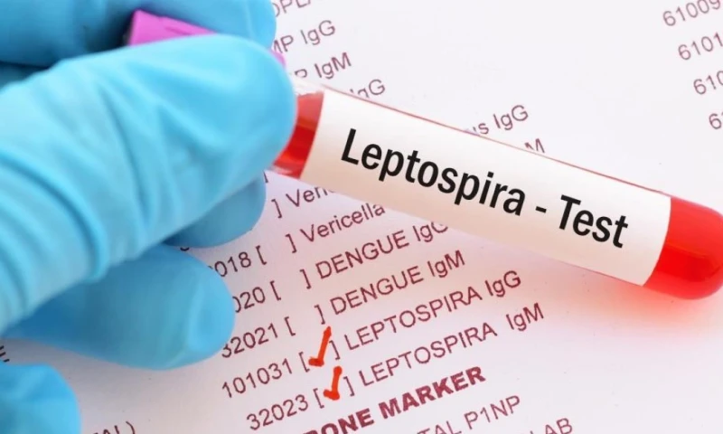 La leptospirosis es una enfermedad que puede transmitirse de animales a personas / Foto: cortesía Medical News Today