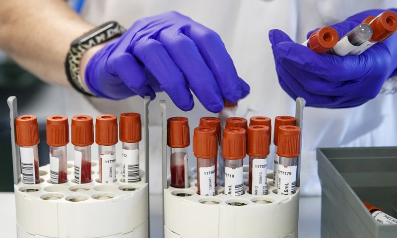 Según la OMS, cada año más de un millón de personas mueren de hepatitis, siendo las más letales las de tipo B y C / Foto: EFE