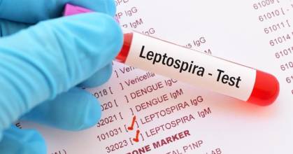 ¿Qué es la leptospirosis, causante de la muerte de 8 niños en Taisha? 
